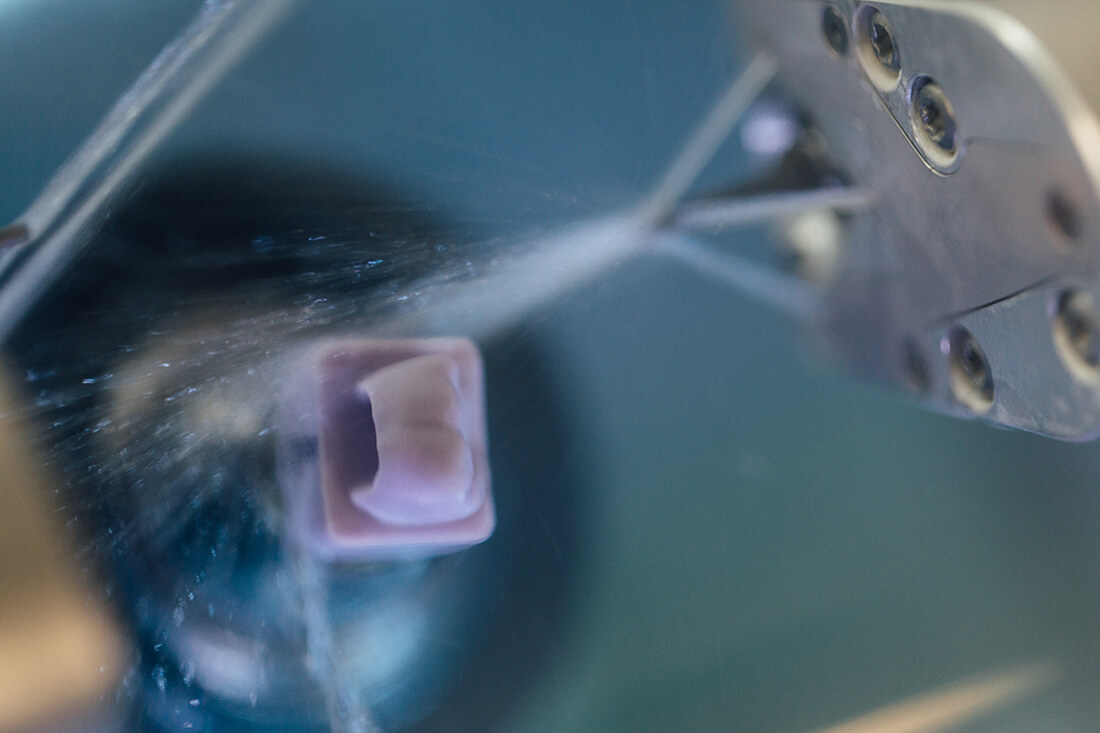 Zahnarzt Puchheim – Gebala – Cerec – schneller Zahnersatz Zahnarzt Puchheim - Gebala - Cerec - schneller Zahnersatz