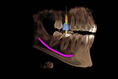 Puchheim-Gebala-Implantologie